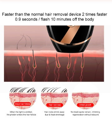 Appareil d'Épilation Laser IPL Professionnel - VikyCharm®